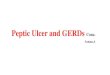 Peptic Ulcer and GERDs - lecture-notes.tiu.edu.iq · 1.Peptic ulcer disease 2. Zollinger–Ellison syndrome 3. Gastroesophageal reflux disease 4. H2-blockers are used preoperatively