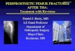 PERIPROSTHETIC FEMUR FRACTURES AFTER THA: Treatment …meeting.aahks.net/wp-content/uploads/2017/05/sp17-symp4... · 2020. 1. 7. · PERIPROSTHETIC FX: THA Loose Stem Revision Principles: