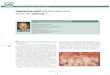 ImplantologíaMultidisciplinaria · 2012. 7. 19. · de regeneración ósea guiada (guided bone regeneration o “GBR”) ha sido una reciente aplicación de las técnicas de regeneración