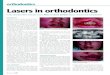 orthodontics Lasers in orthodontics - Smile CreationsLasers in orthodontics In the second of their two-part series, Rita and Arun Darbar discuss ‘trauma and orthodontics’34 April