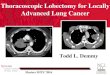 Thoracoscopic Lobectomy for Locally Advanced Lung Cancer · 2017. 9. 19. · undergoing lobectomy for Advanced Lung Cancer 1/1/2002-7/31/2007 11 patients excluded for tumors with