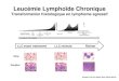 Leucémie Lymphoïde Chronique...Leucémie Lymphoïde Chronique Transformation histologique en lymphome agressif Guièze R, Wu CJ Blood. 2015;126(4):445-53.LLC avant traitement LLC