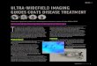 ULTRA-WIDEFIELD IMAGING GUIDES COATS DISEASE ...Coats disease typically affects young males, with diagno-sis at a mean age of 6 years.2 Younger age at presentation is associated with