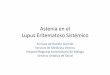 02 Astenia en el LES - FESEMI · 2015. 11. 10. · – Fatigue (Thesaurus del Pubmed): The state of weariness following a period of exertion, mental or physical, characterized by
