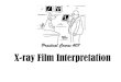 X-ray Film Interpretation · 2021. 1. 15. · X-ray Film Interpretation Author: Mohammed Said Created Date: 11/23/2018 8:57:52 PM 