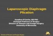 Laparoscopic Diaphragm Plicationaz9194.vo.msecnd.net/pdfs/120401/16.11.pdf · 2012. 5. 25. · Dyspnea Orthopnea . Division of Thoracic and Foregut Surgery Traditional Approach: 