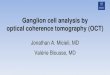 Ganglion cell analysis by optical coherence tomography (OCT) · 2018. 5. 4. · Potential pitfalls in interpreting OCT of the ganglion cell analysis Age of the patient - ensure correct