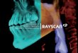 3D Cone beam CT Digital Radiography Dedicated to … · 2021. 3. 31. · RAYSCAN m is an unique 2-in-1 imaging solution, combining Cone Beam CT and Digital Radiography, designed for