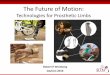 Technologies for Prosthetic Limbs - Harvard University