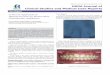 Case Report A Novel Approach to Intrude Incisor by 