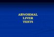 ABNORMAL LIVER TESTS