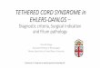 TETHERED CORD SYNDROME in EHLERS-DANLOS