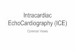 Intracardiac EchoCardiography (ICE)