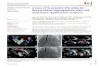 Images in Cardiovascular A Case of Successful MitraClip 