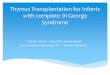 Thymus Transplant for