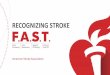 Recognizing stroke f.a.s.t.: Face Arms Speech Time