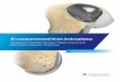 Bi-compartmental Knee Arthroplasty - Zimmer Biomet