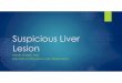 Suspicious Liver Lesion - University of Virginia School of 
