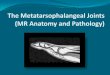 The Metatarsophalangeal Joints (MR Anatomy and Pathology)