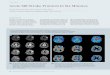 Acute MR Stroke Protocol in Six Minutes - Siemens Medical Solutions