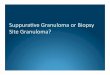 DDX Suppurative Granuloma versus Biopsy Site Scar and
