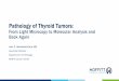 Pathology of Thyroid Tumors