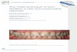 The “index technique” in worn dentition: a new and 