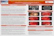 Jatana Poster FS - ResearchPosters