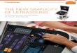 THE NEW SIMPLICITY OF ULTRASOUND
