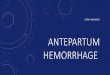ANTEPARTUM HEMORRHAGE - كلية الطب