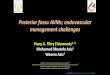 Posterior fossa AVMs; endovascular management challenges