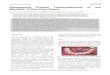 Intraosseous Primary Leiomyosarcoma of the Mandible: A 