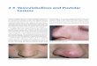 Vesiculobullous and Pustular Lesions