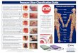 Pressure Ulcer Classification Guide 1