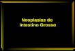 Neoplasias do Intestino Grosso
